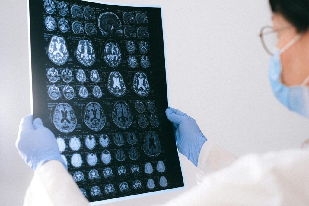 bilim insanlari alzheimerin beyin hucresi olumune yol acan temel proteini belirledi SaN47lKR