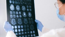 bilim insanlari alzheimerin beyin hucresi olumune yol acan temel proteini belirledi SaN47lKR