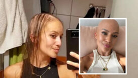 gogus buyutme ameliyatina giren cek dis hekimi barbora kropackova ameliyattan sonra kel kaldi KXN1EyCW
