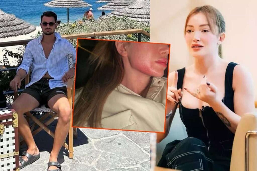 danla bilic eski erkek arkadasi berk cetin tarafindan yumruklanarak darp edildigini soyledi vyZKj7kh