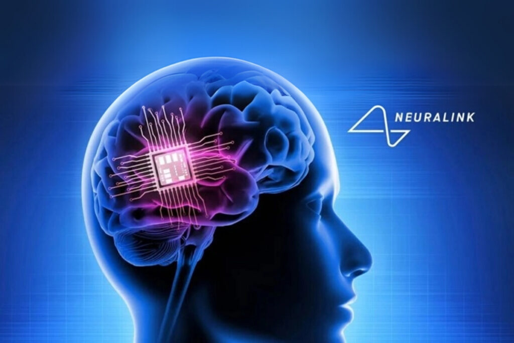 neuralink beyin cipi programina gonullu denekler araniyor cnvyWq1S