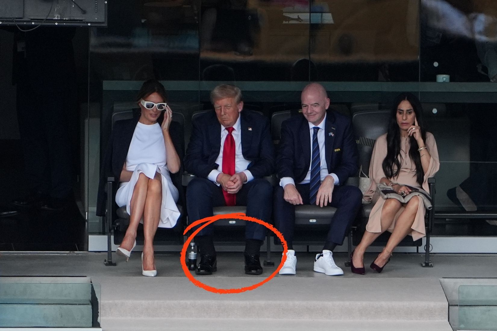 abd baskani donald trumpin ellerindeki morluklarin ve ayaklarindaki sisliklerin sebebi aciklandi 2 8Rf29c2t