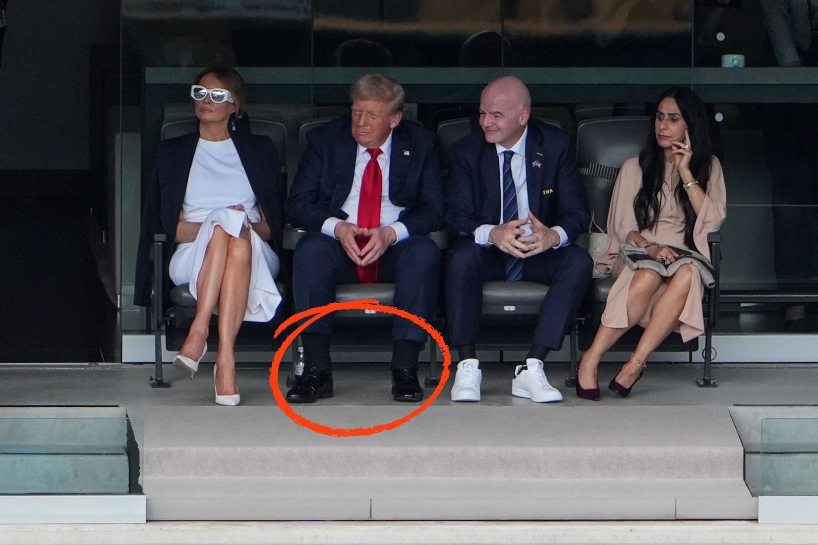 abd baskani donald trumpin ellerindeki morluklarin ve ayaklarindaki sisliklerin sebebi aciklandi 3 MrBevVp8