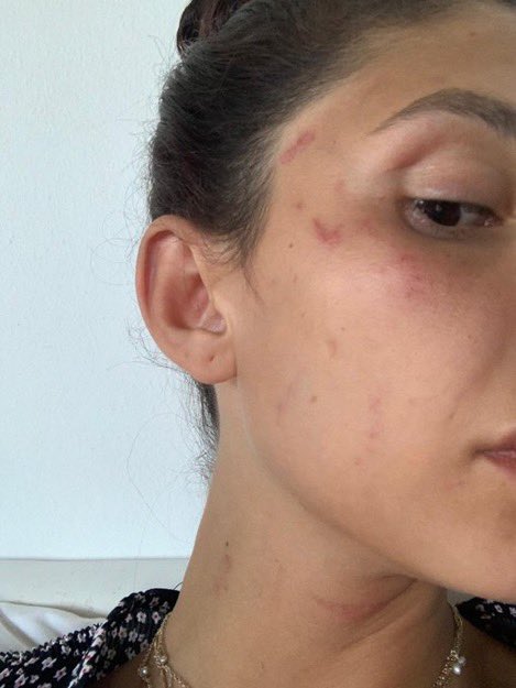 can yamanin sevgilisi sara bluma artik susmayacagim diyerek kanlar icinde paylasim yapti 0 2HN5IWNs