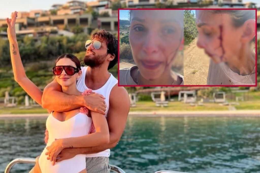 can yamanin sevgilisi sara bluma artik susmayacagim diyerek kanlar icinde paylasim yapti U2AM6mR7