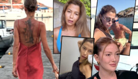 ikinci danla bilic vakasi nazli kayaslan ameliyattan cikar cikmaz uyardi sakin yaptirmayin 7I4bf382