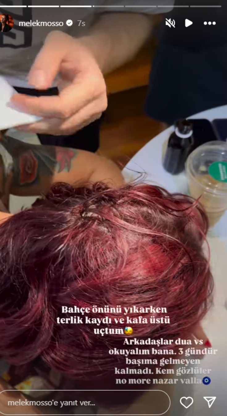 melek mosso tatilde terlik kazasinda yaralandi 0 1eHPTGb6