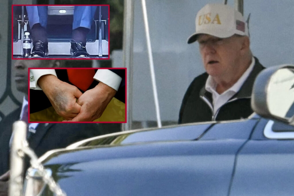 donald trump 6 gun sonra ilk kez goruntulendi solgun hali dikkat cekti ev3nkE2w