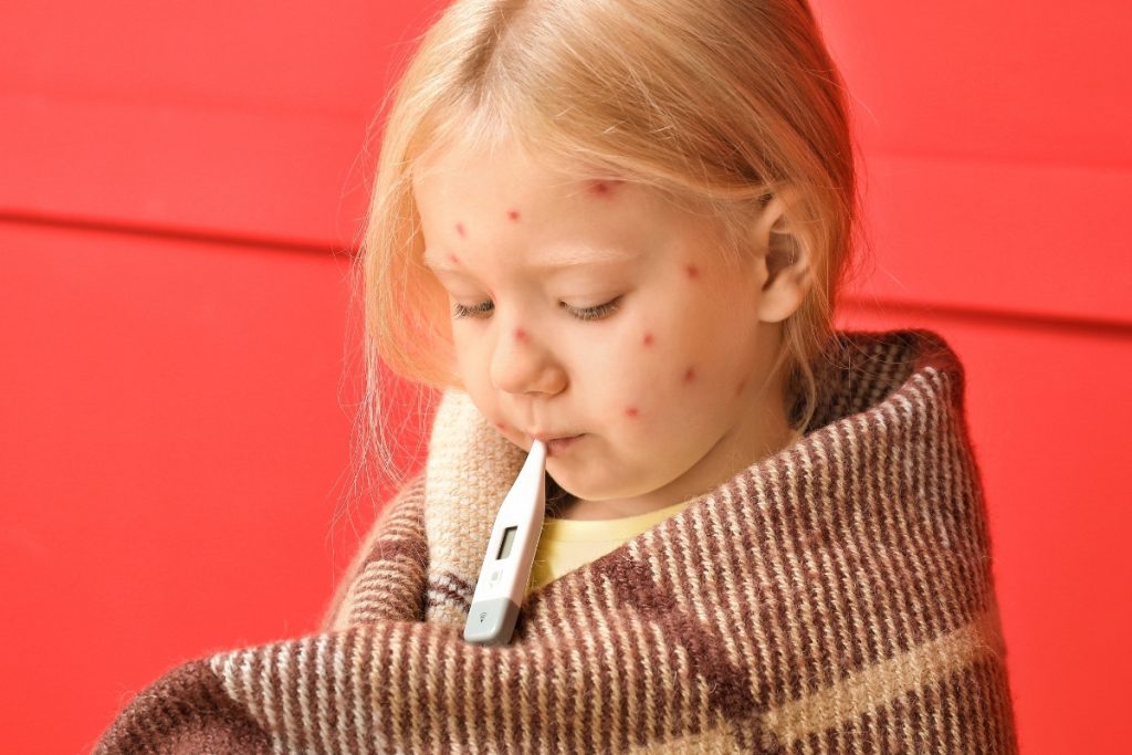 turkiyede su cicegi vakalari artiyor tek doz asi koruma saglamiyor HlDvlcrs