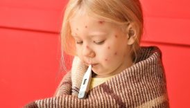 turkiyede su cicegi vakalari artiyor tek doz asi koruma saglamiyor HlDvlcrs